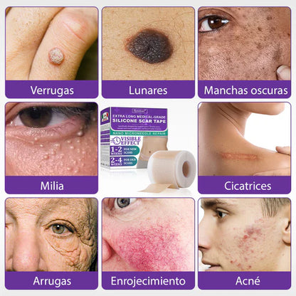 Flysmus® Reducción de cicatrices