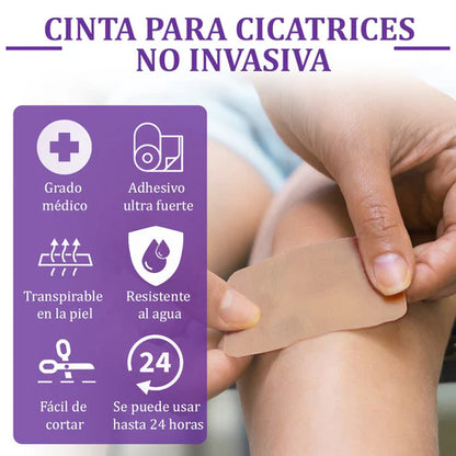 Flysmus® Reducción de cicatrices