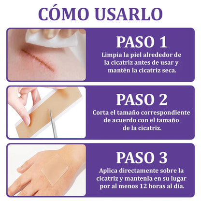Flysmus® Reducción de cicatrices