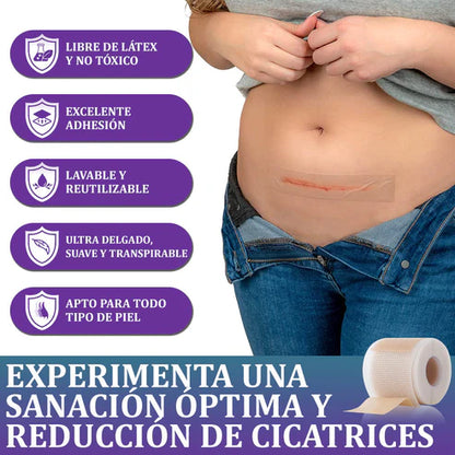 Flysmus® Reducción de cicatrices