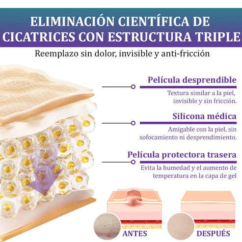 Flysmus® Reducción de cicatrices