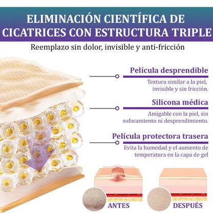 Flysmus® Reducción de cicatrices